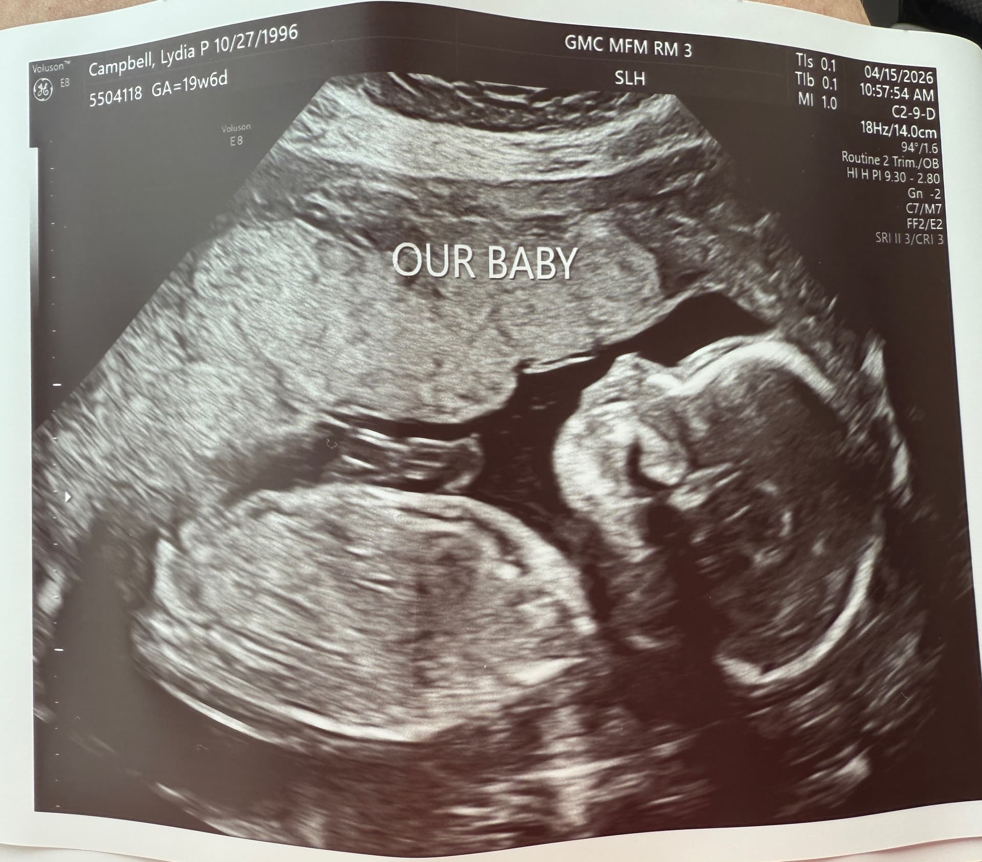 Sonogram of our son